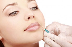 Dermal Filler Injection of the Lips for Volume