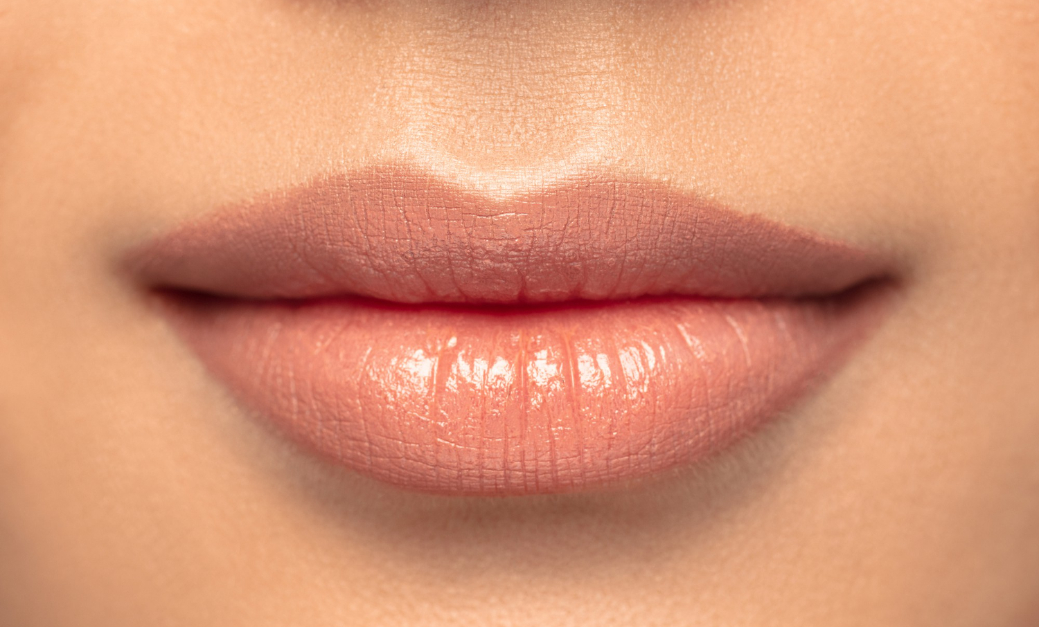 Woman with fuller lips after Lip Fillers in NYC treatment