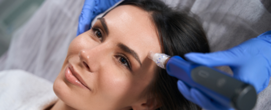 Microneedling with SkinPen®: Smooth, Bright, and Rejuvenated Skin at Anand Medical Spa